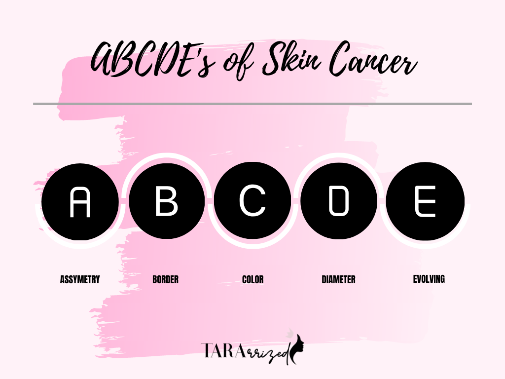 The ABCDE of skin cancer